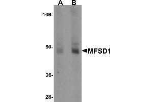 Western Blotting (WB) image for anti-Major Facilitator Superfamily Domain Containing 1 (MFSD1) (Middle Region) antibody (ABIN1031003) (MFSD1 antibody  (Middle Region))