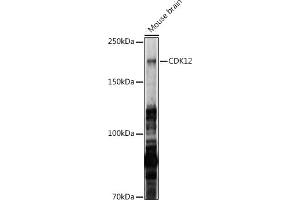 Western blot analysis of extracts of Mouse brain, using CDK12 antibody (ABIN7266230) at 1:1000 dilution.