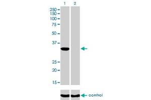 Western blot analysis of ITPK1 over-expressed 293 cell line, cotransfected with ITPK1 Validated Chimera RNAi (Lane 2) or non-transfected control (Lane 1).