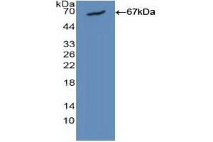 Detection of Recombinant CALM1, Human using Polyclonal Antibody to Calmodulin 1 (CALM1) (Calmodulin 1 antibody  (AA 1-149))