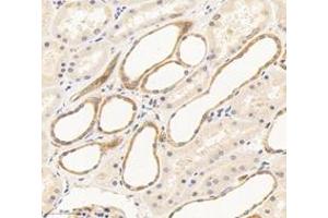 Immunohistochemistry analysis of paraffin-embedded human kidney using,THEA (ABIN7072933) at dilution of 1: 1600 (ACOT11 antibody)