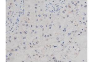 Immunohistochemistry (IHC) image for anti-Microtubule-Associated Protein tau (MAPT) (pThr205) antibody (ABIN6255625)