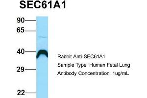 Host: Rabbit  Target Name: SEC61A1  Sample Tissue: Human Fetal Lung  Antibody Dilution: 1. (SEC61A1 antibody  (C-Term))