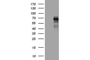 Image no. 1 for anti-Tumor Necrosis Factor Receptor Superfamily, Member 8 (TNFRSF8) (AA 19-379) antibody (ABIN1491089) (TNFRSF8 antibody  (AA 19-379))