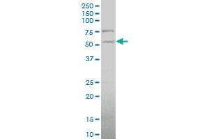 PDHX polyclonal antibody (A01), Lot # 051213JCO1 Western Blot analysis of PDHX expression in HepG2 . (PDHX antibody  (AA 1-109))