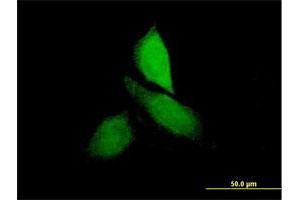 Immunofluorescence of purified MaxPab antibody to CNKSR3 on HeLa cell. (CNKSR3 antibody  (AA 1-555))