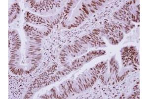 Image no. 1 for anti-Decapping Enzyme, Scavenger (DCPS) (AA 1-149) antibody (ABIN1497779) (DCPS antibody  (AA 1-149))