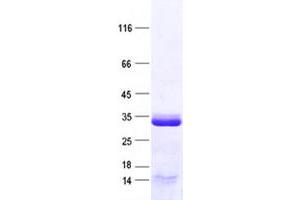 Validation with Western Blot (CCNYL1 Protein (His tag))