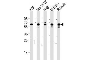 All lanes : Anti-DPYSL5 Antibody (C-term) at 1:2000 dilution Lane 1: Y79 whole cell lysates Lane 2: SH-SY5Y whole cell lysates Lane 3: Raji whole cell lysates Lane 4: mouse brain lysates Lane 5: rat brain lysates Lysates/proteins at 20 μg per lane. (DPYSL5 antibody  (C-Term))