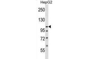 Western Blotting (WB) image for anti-Solute Carrier Family 12 (Potassium-Chloride Transporter) Member 7 (SLC12A7) antibody (ABIN2996710) (SLC12A7 antibody)