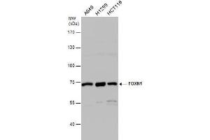 WB Image FOXN1 antibody [C3], C-term detects FOXN1 protein by western blot analysis. (FOXN1 antibody  (C-Term))