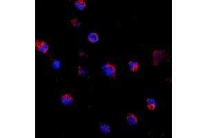 IF analysis of CD69 using anti-CD69 antibody (ABIN7599623). (CD69 antibody  (AA 101-148))