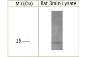 WB on rat brain lysate using Sheep antibody to human, rat, mouse GABA(A) receptor-associated protein (GABARAP, MM46, FLC3B): IgG at a concentration of 5 µg/ml under reducing condition. (GABARAP antibody)