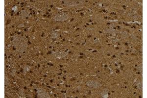 ABIN6261096 and ABIN6276787 at 1/100 staining Rat brain tissue by IHC-P. (CTNND1 antibody  (C-Term))