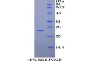 SDS-PAGE (SDS) image for Matrix Metallopeptidase 9 (Gelatinase B, 92kDa Gelatinase, 92kDa Type IV Collagenase) (MMP9) protein (ABIN1880145) (MMP 9 Protein)