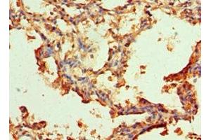 Immunohistochemistry of paraffin-embedded human lung tissue using ABIN7143754 at dilution of 1:100