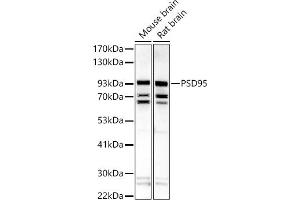 Western blot analysis of extracts of various cell lines, using PSD95 antibody (ABIN6134334, ABIN6139650, ABIN7101791 and ABIN7101792) at 1:500 dilution.