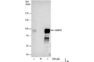 IP Image Immunoprecipitation of SOX13 protein from NT2D1 whole cell extracts using 5 μg of SOX13 antibody [N1C3], Western blot analysis was performed using SOX13 antibody [N1C3], EasyBlot anti-Rabbit IgG  was used as a secondary reagent. (SOX13 antibody)