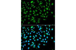 Immunofluorescence analysis of A549 cells using ING3 antibody. (ING3 antibody)