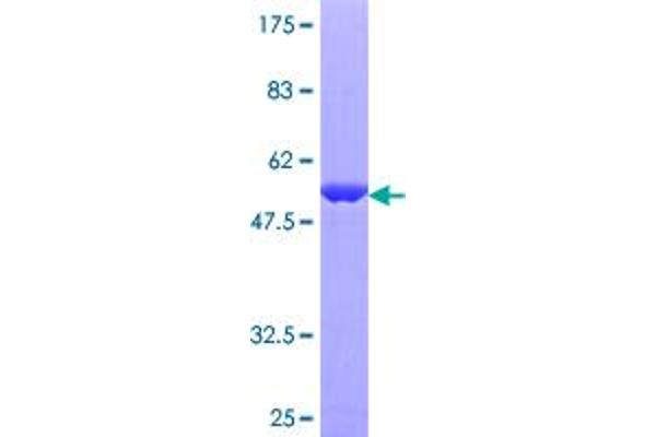 RAB11B Protein (AA 1-218) (GST tag)