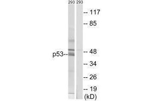 Western blot analysis of extracts from 293 cells, using p53 (Ab-378) antibody. (p53 antibody  (Ser378))