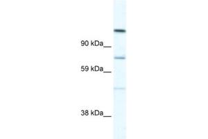 Western Blotting (WB) image for anti-Ras Association and DIL Domains (Radil) antibody (ABIN2461554) (Radil antibody)