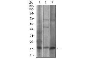 Western blot analysis using CAV2 mouse mAb against A549 (1), 3T3-L1 (2), A431 (3) cell lysate.