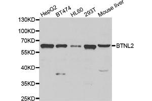 Western blot analysis of extracts of various cell lines, using BTNL2 antibody (ABIN5975278) at 1/1000 dilution. (BTNL2 antibody)
