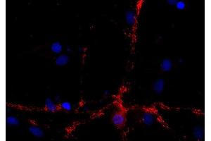 Indirect immunostaining of PFA fixed rat hippocampus neurons (dilution 1 : 500; red). (DNAJC5 antibody)