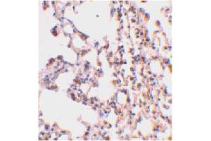 Immunohistochemical staining of mouse lung tissue using BID polyclonal antibody  at 2 ug/mL . (BID antibody  (C-Term))