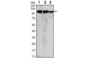 Western Blot showing HK2 antibody used against Jurkat (1), Hela (2) and HEK293 (3) cell lysate. (Hexokinase 2 antibody)