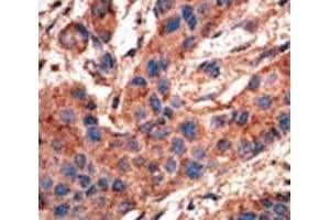 Immunohistochemistry (IHC) image for anti-Bone Morphogenetic Protein Receptor 1A (BMPR1A) (AA 30-60) antibody (ABIN3030186)