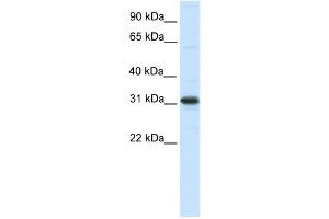 WB Suggested Anti-NRIP2 Antibody Titration:  0. (NRIP2 antibody  (N-Term))