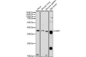 Western blot analysis of extracts of various cell lines, using MR1 antibody (ABIN6131925, ABIN6143983, ABIN6143984 and ABIN6224070) at 1:1000 dilution. (MR1 antibody  (AA 20-260))