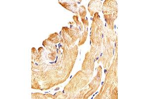 Immunohistochemical analysis of paraffin-embedded H. (SMAD1 antibody  (AA 163-196))