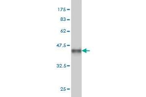 Western Blot detection against Immunogen (35. (CDK8 antibody  (AA 375-464))