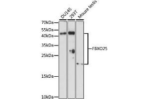 Western blot analysis of extracts of various cell lines, using FBXO25 antibody (ABIN7267087) at 1:1000 dilution. (FBXO25 antibody  (AA 142-291))