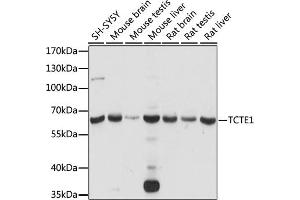Western blot analysis of extracts of various cell lines, using TCTE1 antibody (ABIN7270710) at 1:1000 dilution. (TCTE1 antibody  (AA 1-300))