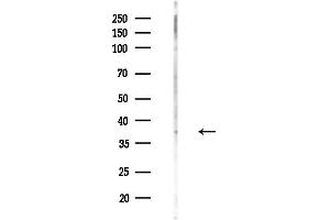 anti-Prolactin Releasing Hormone Receptor (PRLHR) (Internal Region) antibody
