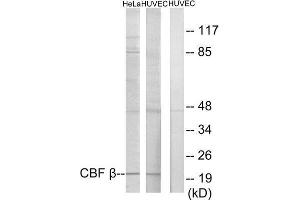 Western Blotting (WB) image for anti-Core-Binding Factor, beta Subunit (CBFB) (N-Term) antibody (ABIN1849582) (CBFB antibody  (N-Term))