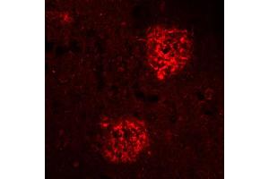 Immunohistochemistry (IHC) image for anti-Amyloid beta 1-40 (Abeta 1-40) (AA 33-40) antibody (ABIN1742442) (Abeta 1-40 antibody  (AA 33-40))
