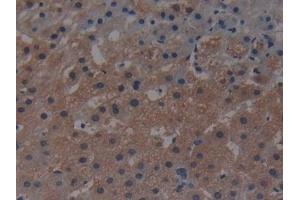 Detection of MAP3K1 in Human Liver Tissue using Polyclonal Antibody to Mitogen Activated Protein Kinase Kinase Kinase 1 (MAP3K1) (MAP3K1 antibody  (AA 1307-1509))
