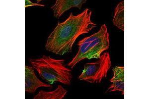 Image no. 7 for anti-ATP Citrate Lyase (ACLY) antibody (ABIN1491378) (ACLY antibody)