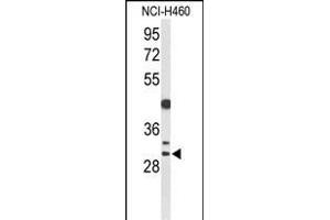 Western blot analysis of CCNB1IP1 Antibody (C-term) (ABIN653349 and ABIN2842829) in NCI- cell line lysates (35 μg/lane). (CCNB1IP1 antibody  (C-Term))