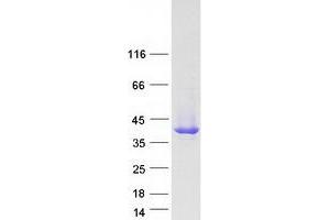 SERPINB1 Protein (Myc-DYKDDDDK Tag)