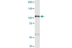 SEMA6B monoclonal antibody (M01), clone 2H7.