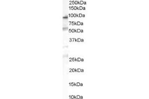 Image no. 1 for anti-Oxysterol Binding Protein-Like 10 (OSBPL10) (Internal Region) antibody (ABIN374621)