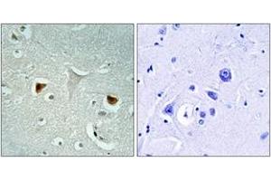 Immunohistochemistry analysis of paraffin-embedded human brain tissue, using STAT3 (Ab-727) Antibody. (STAT3 antibody  (AA 694-743))