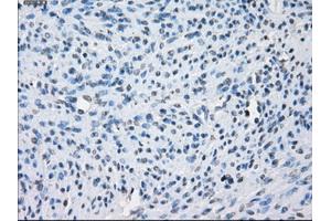 Immunohistochemical staining of paraffin-embedded colon tissue using anti-AURKCmouse monoclonal antibody. (Aurora Kinase C antibody)