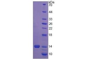 Image no. 1 for Procollagen-Lysine,2-Oxoglutarate 5-Dioxygenase 1 (PLOD1) (AA 636-727) protein (His tag) (ABIN4990200) (PLOD1 Protein (AA 636-727) (His tag))